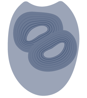 Fertilized egg