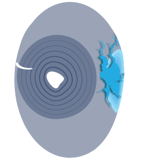 Fertilized egg