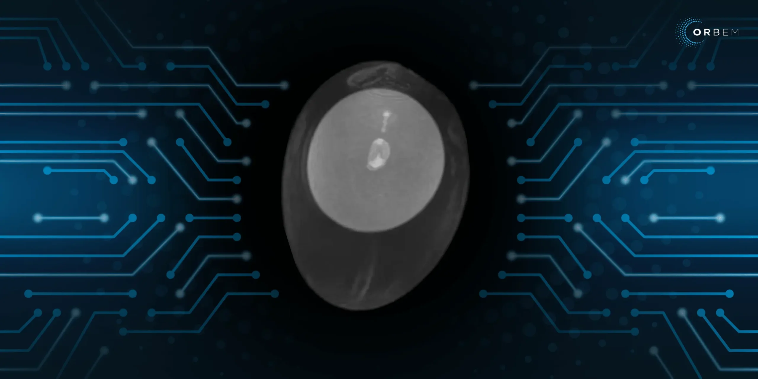 MRI egg classifcation orbem