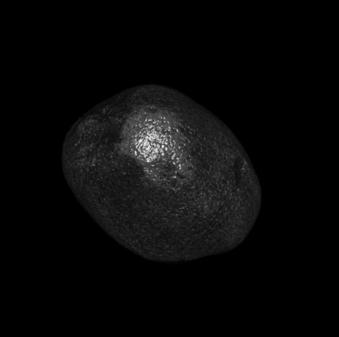 Kiwi MRI 